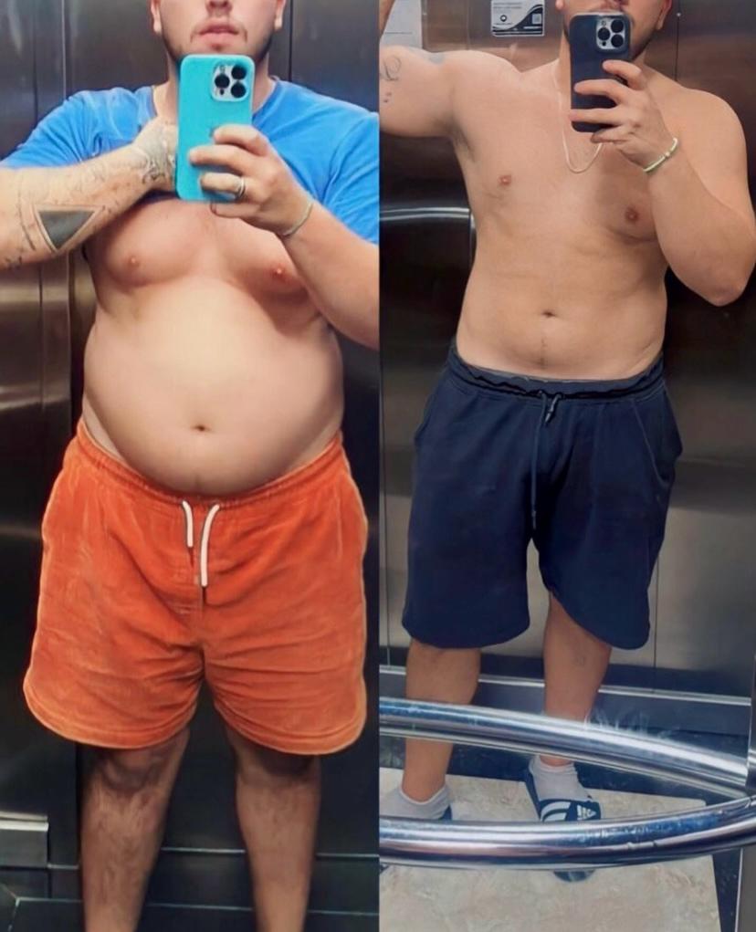 Antes e depois 3